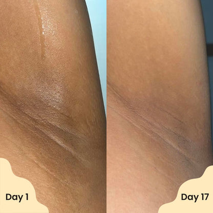 ✨ Nexisify® Vanilla Pistachio Brightening Deodorant — Smooth skin Underarms in Just Weeks 💛 ✨